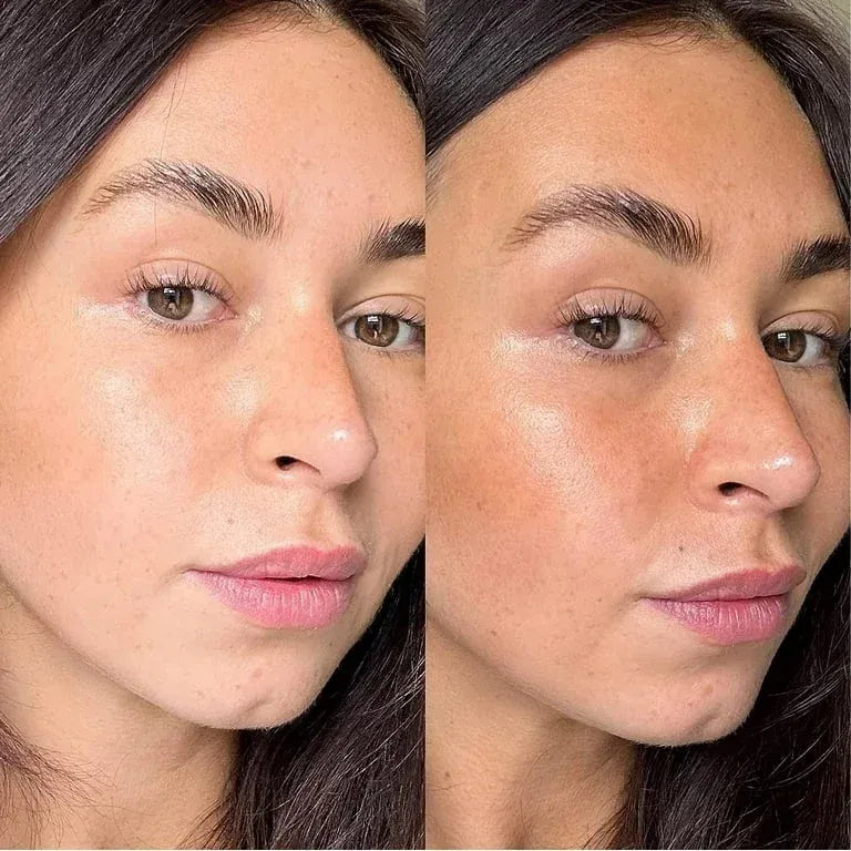 Avant après visage